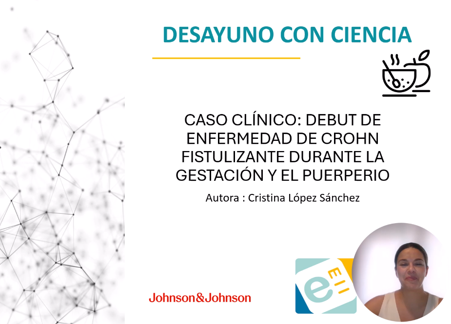 Desayuno con ciencia: enfermedad crohn fistulizante en gestación y puerperio